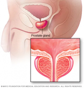 Cross section illustration of prostate gland