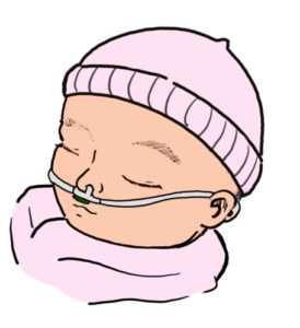 This is a cartoon image of an infant baby with a pink cap wearing a smart nasal cannula monitoring their breathing